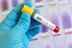 Health Insurance for HIV Patients in India- Inclusions and Exclusions