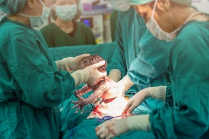 Is cesarean delivery covered by health insurance?