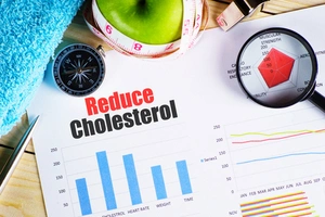 Smart Lifestyle Changes Will Lower Your Cholesterol Levels 