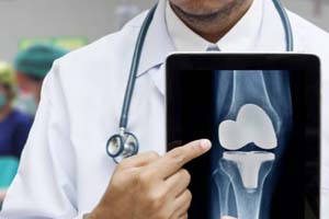 Do Health Insurance Cover Orthopaedic Surgery?