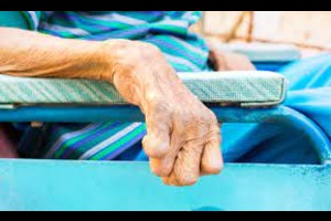 Leprosy Health Insurance: Causes, Symptoms, And Treatment